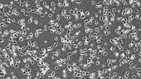 Neuroplasticity in focus